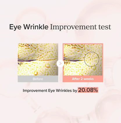 Avec Rétinal + Niacinamide – Correction des poches